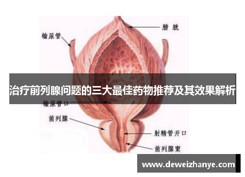 治疗前列腺问题的三大最佳药物推荐及其效果解析 治疗前列腺问题的三大最佳药物推荐及其效果解析